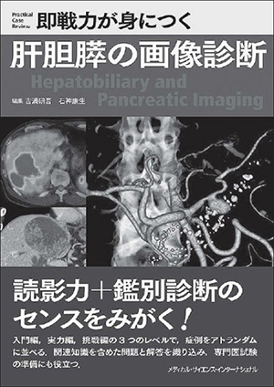 即戦力が身につく肝胆膵の画像診断