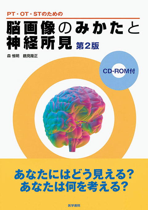 脳画像のみかたと神経所見　第2版