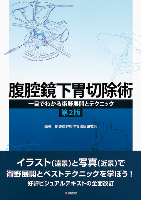 腹腔鏡下胃切除術 第2版   書籍詳細   書籍   医学書院