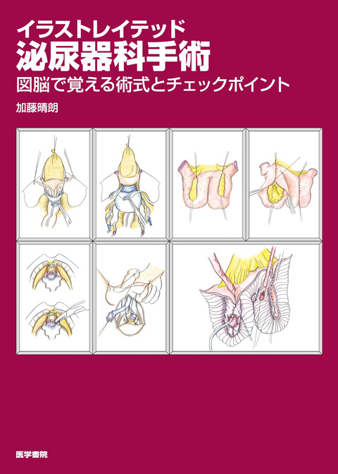 イラストレイテッド泌尿器科手術