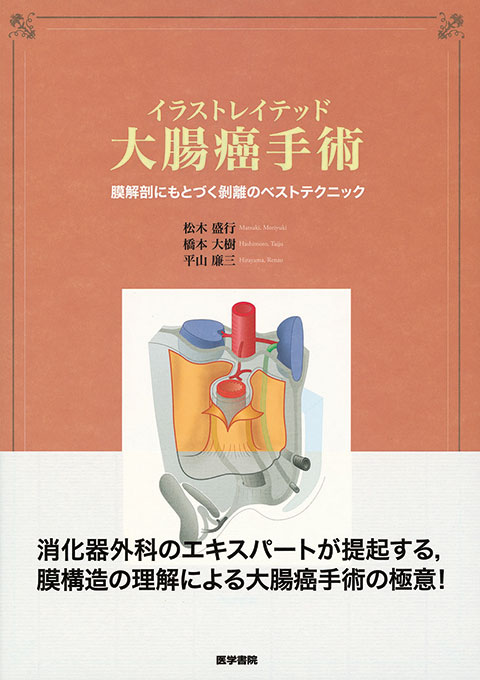 イラストレイテッド大腸癌手術 書籍詳細 書籍 医学書院