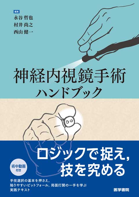 神経内視鏡手術ハンドブック　
