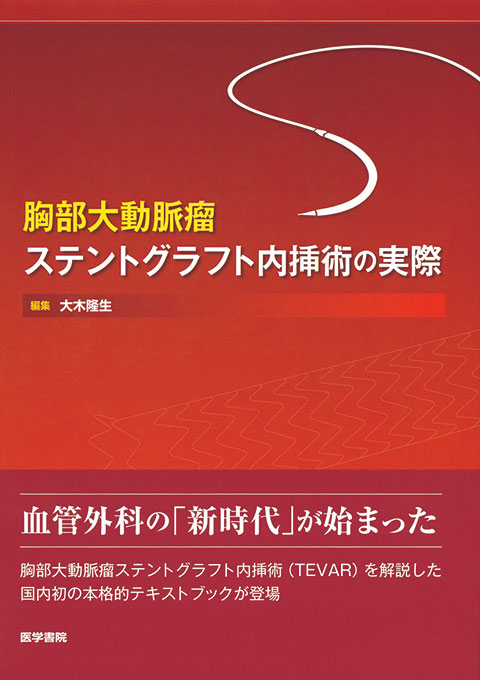 胸部大動脈瘤ステントグラフト内挿術の実際