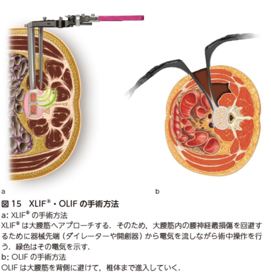 図15.jpg