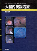 大腸内視鏡治療