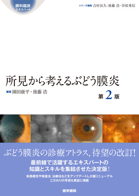 眼科臨床エキスパート　所見から考えるぶどう膜炎　第2版