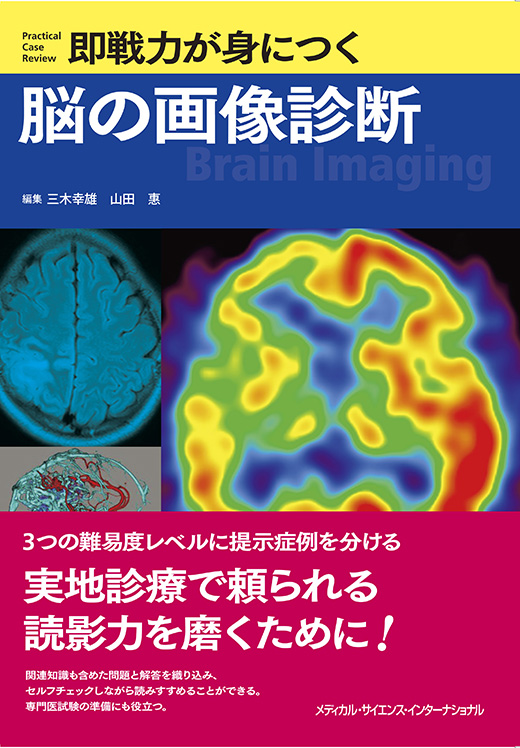 即戦力が身につく脳の画像診断