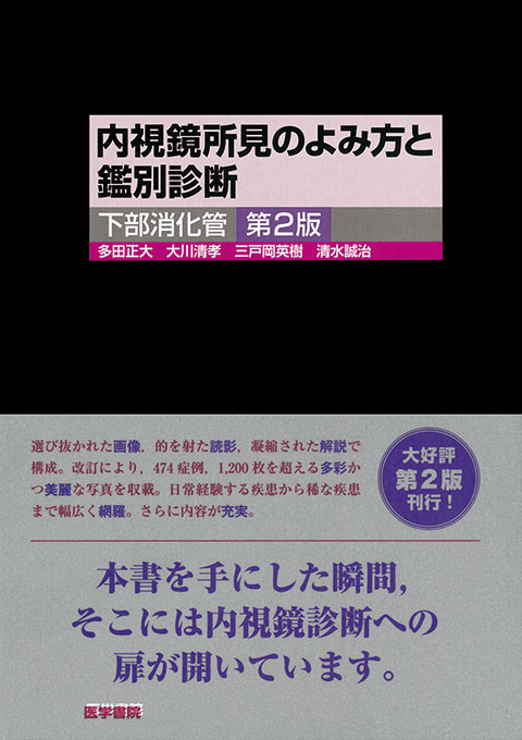 内視鏡所見のよみ方と鑑別診断－下部消化管　第2版