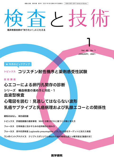 検査と技術 Vol.49 No.1