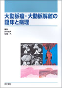 大動脈瘤・大動脈解離の臨床と病理