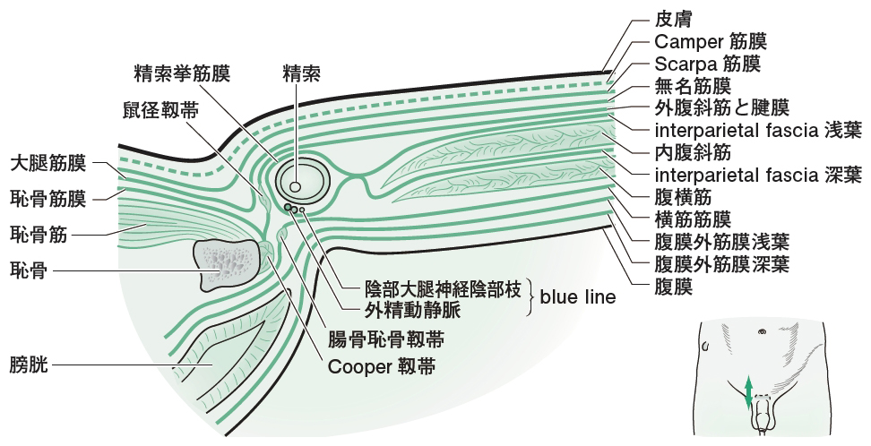 勃起不全auaガイドラインpdf