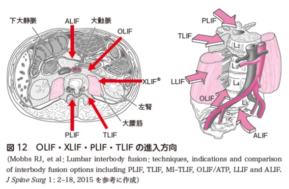 図12.jpg