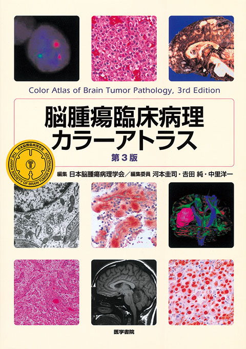 脳腫瘍臨床病理カラーアトラス 第3版 | 書籍詳細 | 書籍 | 医学書院