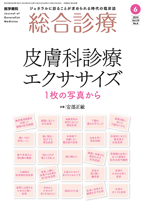 総合診療 Vol.29 No.6