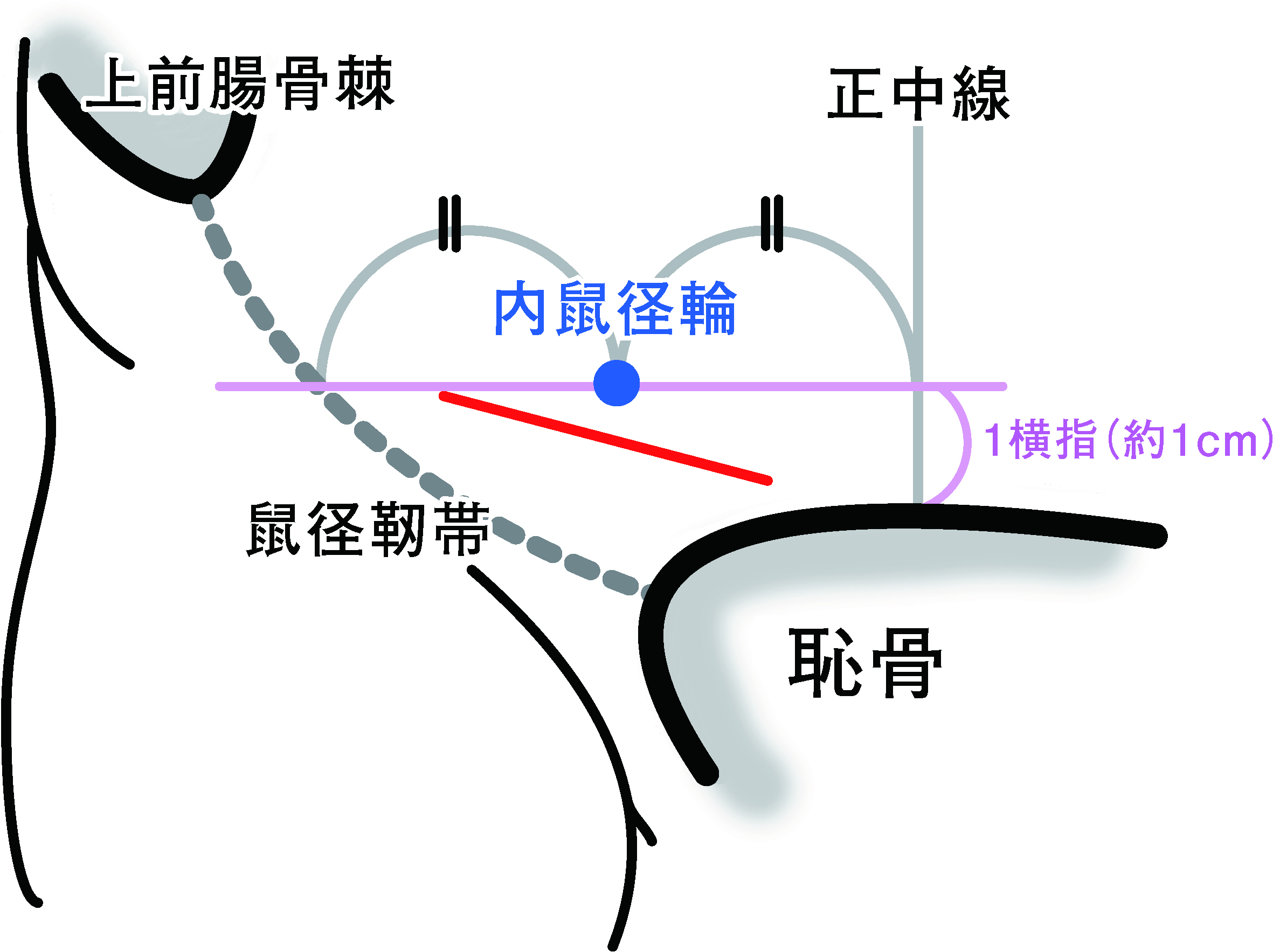 3573号_Web用_図1.jpg
