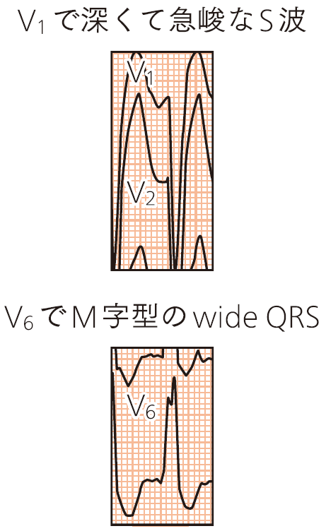 04_zu05.png