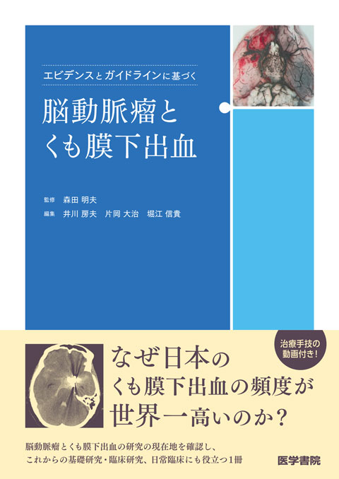 エビデンスとガイドラインに基づく脳動脈瘤とくも膜下出血　