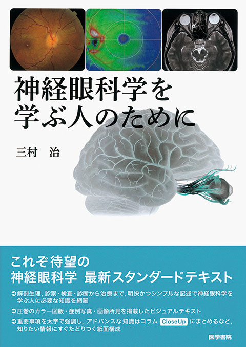 神経眼科学を学ぶ人のために