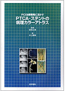 PTCA・ステントの病理カラーアトラス