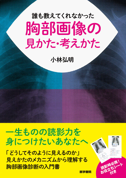 誰も教えてくれなかった胸部画像の見かた・考えかた