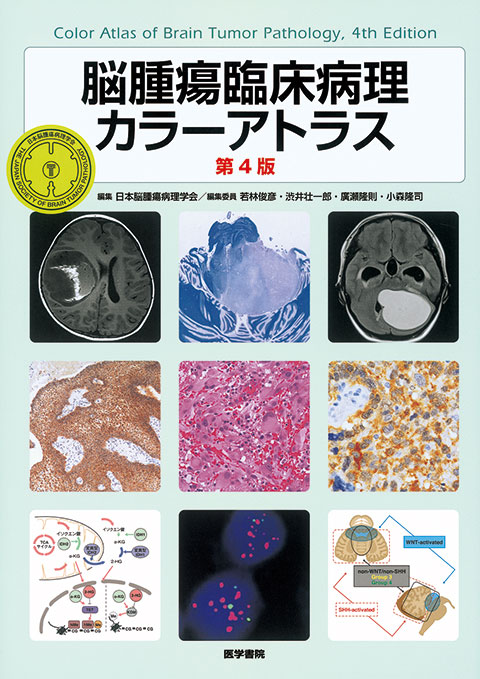 脳腫瘍臨床病理カラーアトラス 第4版 | 書籍詳細 | 書籍 | 医学書院