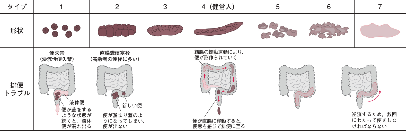 生理前排便多い, 一日の排便回数が多い要因 – KLWZJ