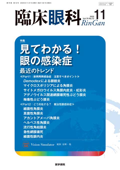 臨床眼科 Vol.79 No.12