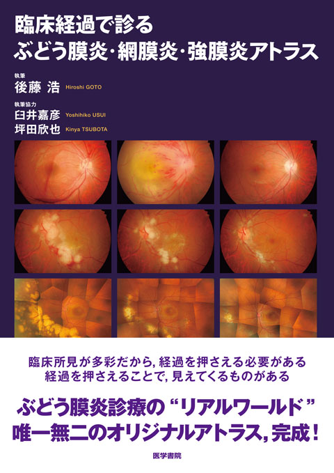 臨床経過で診る ぶどう膜炎・網膜炎・強膜炎アトラス　