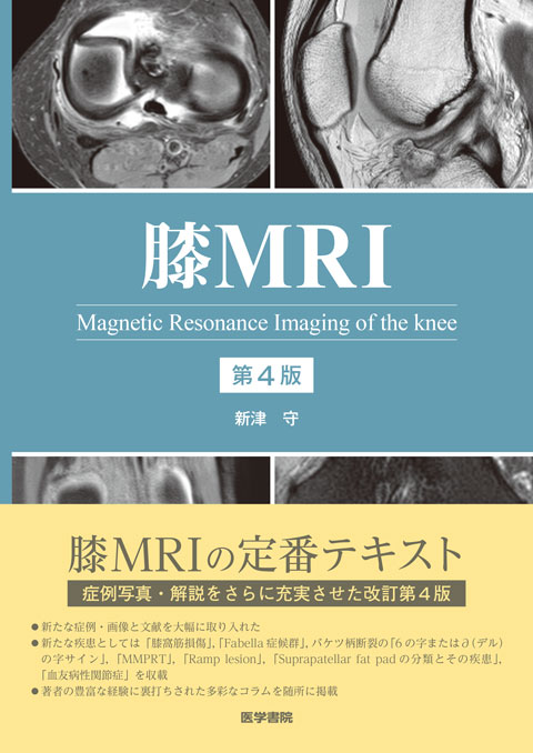 膝MRI　第4版