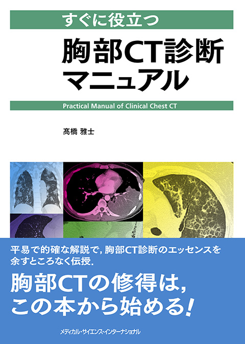 すぐに役立つ胸部CT診断マニュアル