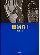 膝MRI