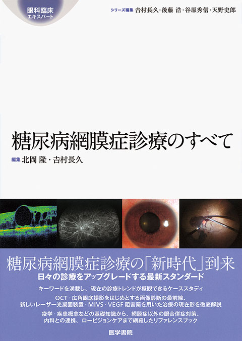 糖尿病網膜症診療のすべて