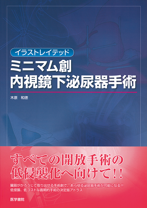 図解 泌尿器科手術 | 書籍詳細 | 書籍 | 医学書院