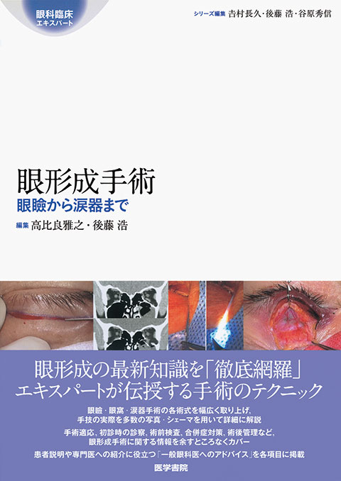 【裁断済み】眼内腫瘍アトラス