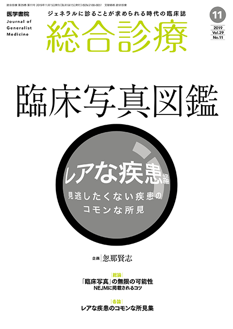 総合診療 Vol.29 No.11