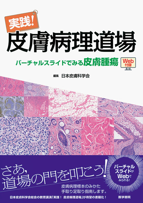 実践！ 皮膚病理道場　バーチャルスライドでみる皮膚腫瘍　［Web付録付］