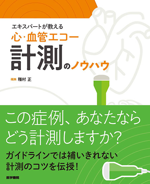 エキスパートが教える　心・血管エコー計測のノウハウ