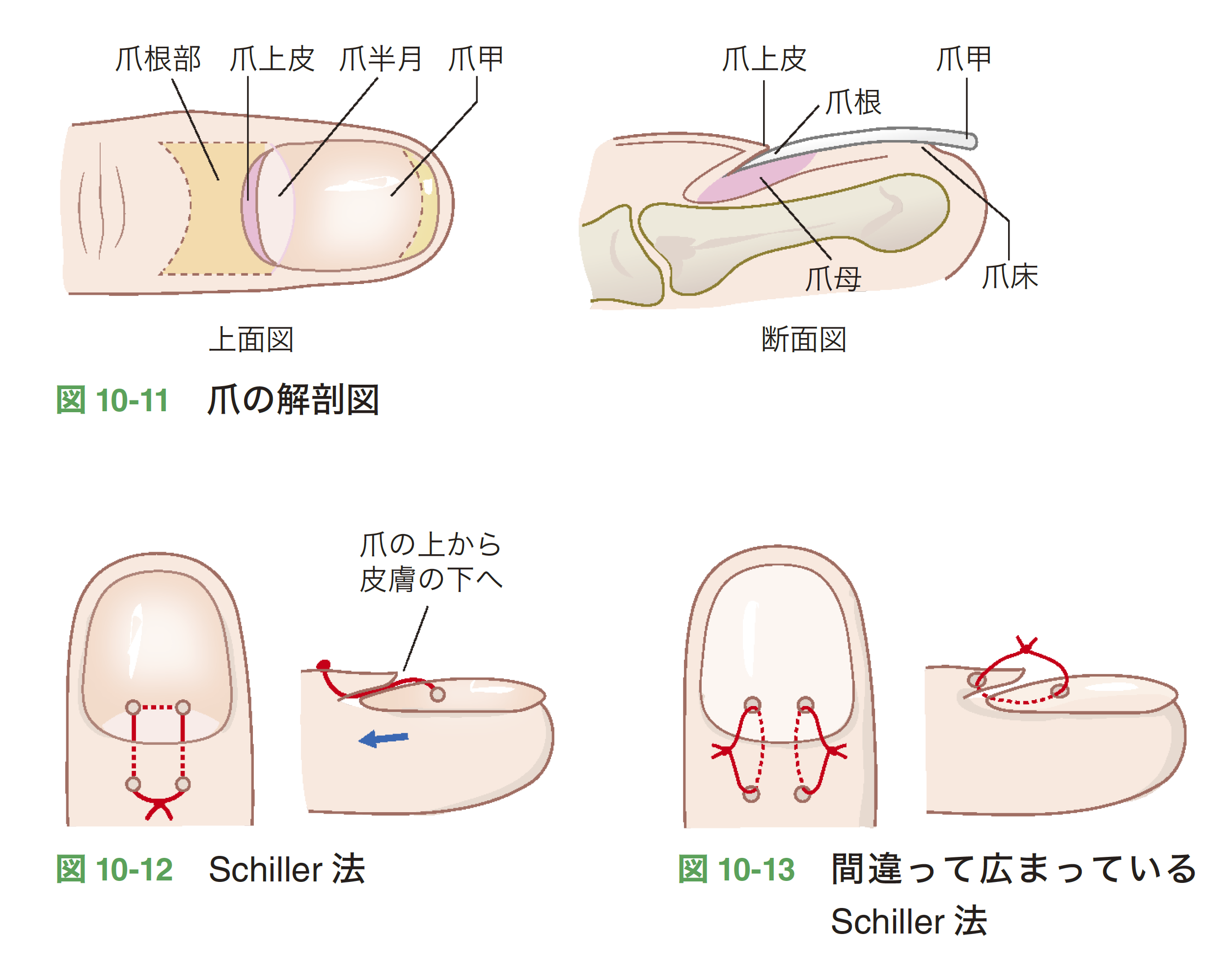 図10-11-13.png