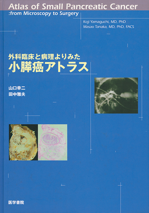 外科臨床と病理よりみた小膵癌アトラス