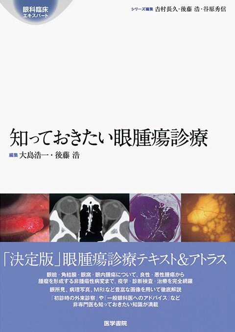 知っておきたい眼腫瘍診療