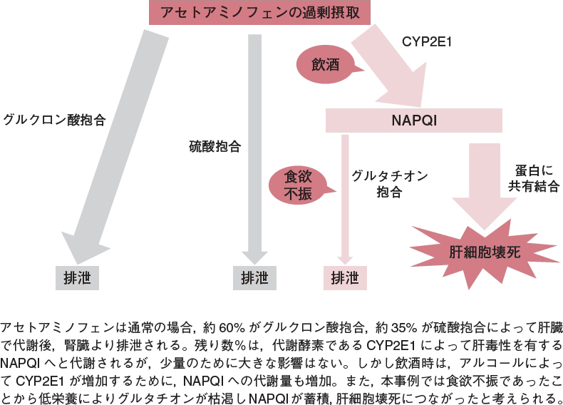 カロナール イブプロフェン 【漫画付き】「ロキソニン」や「イブプロフェン」は、どんな痛みでも服用して大丈夫？