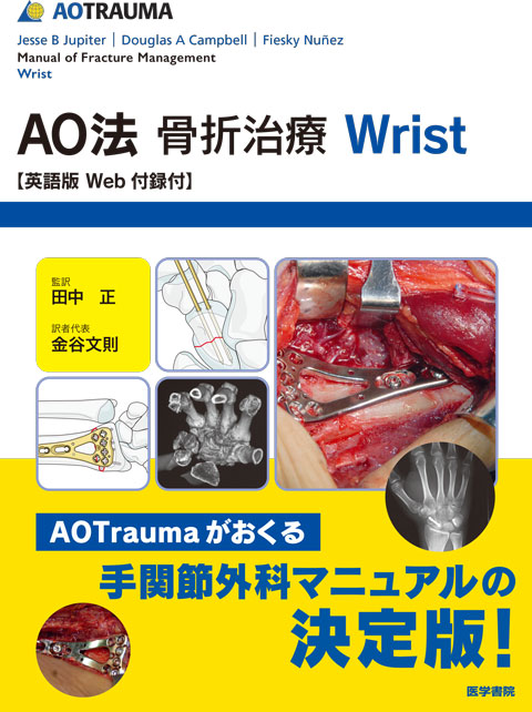 AO法骨折治療 Wrist　