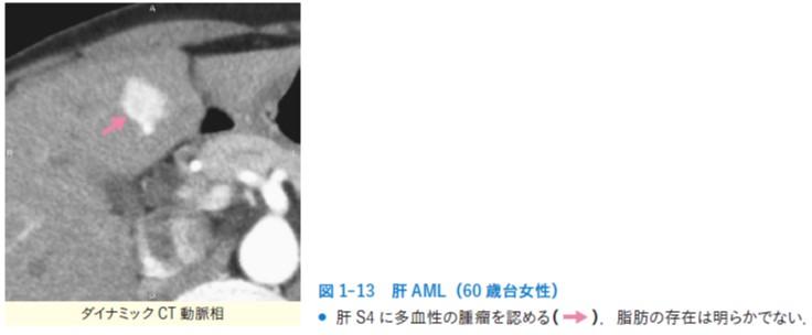 図1-13.jpg