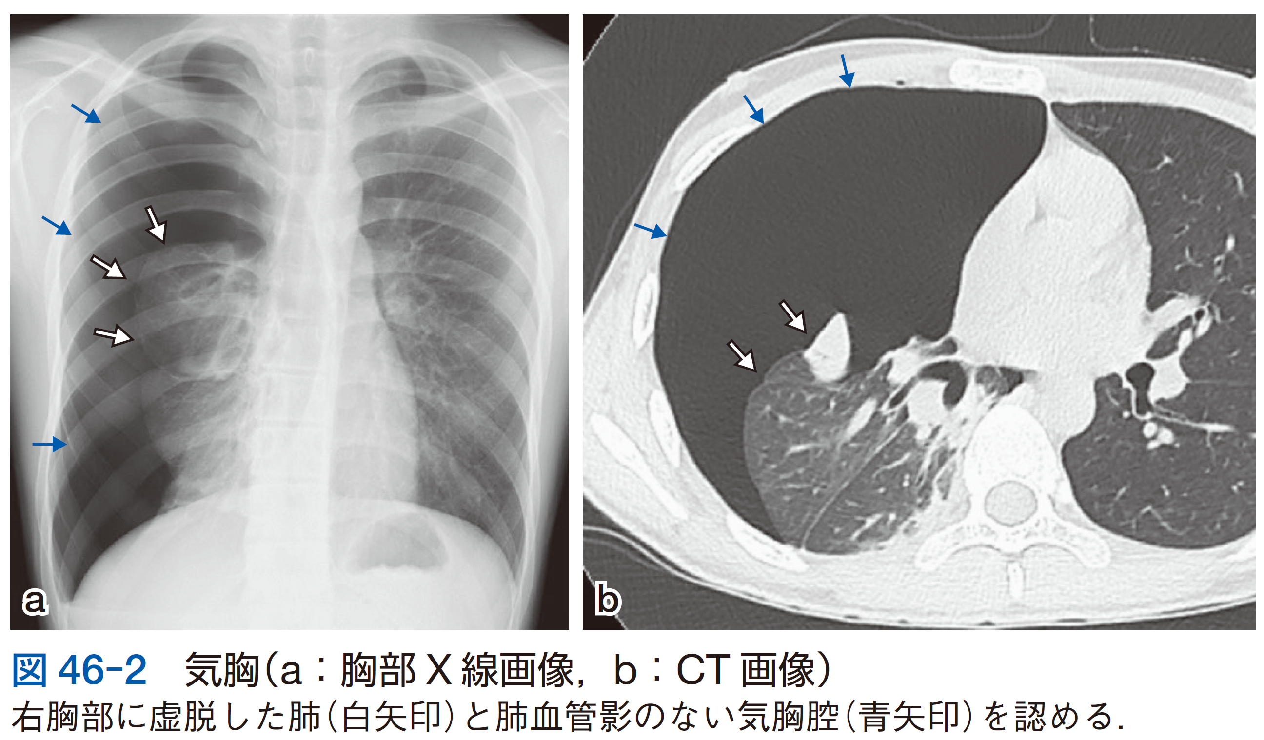 医学界新聞プラス ［第3回］X線検査 | | 記事一覧 | 医学界新聞 | 医学書院