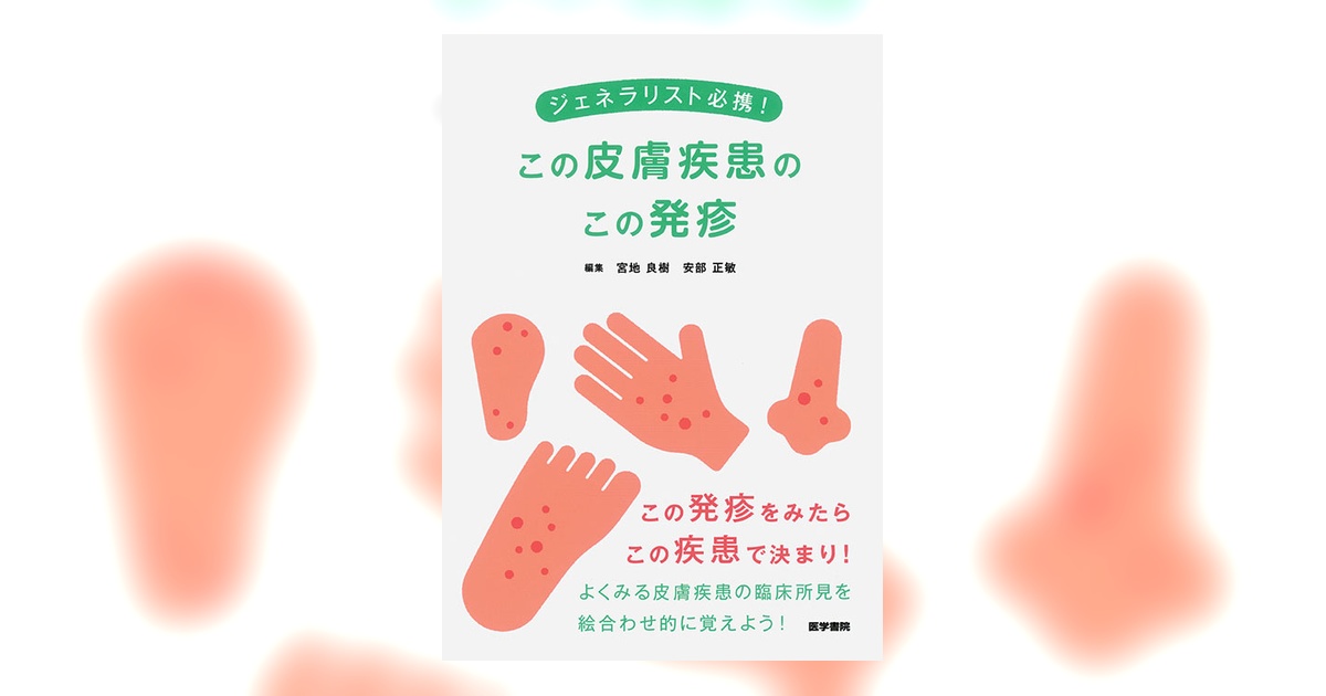 湿疹のすべて　裁断済み m3電子書籍 | 湿疹のすべて