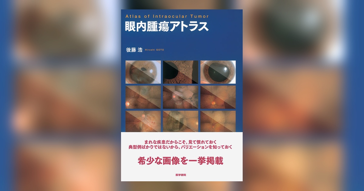 眼内腫瘍アトラス | 書籍詳細 | 書籍 | 医学書院