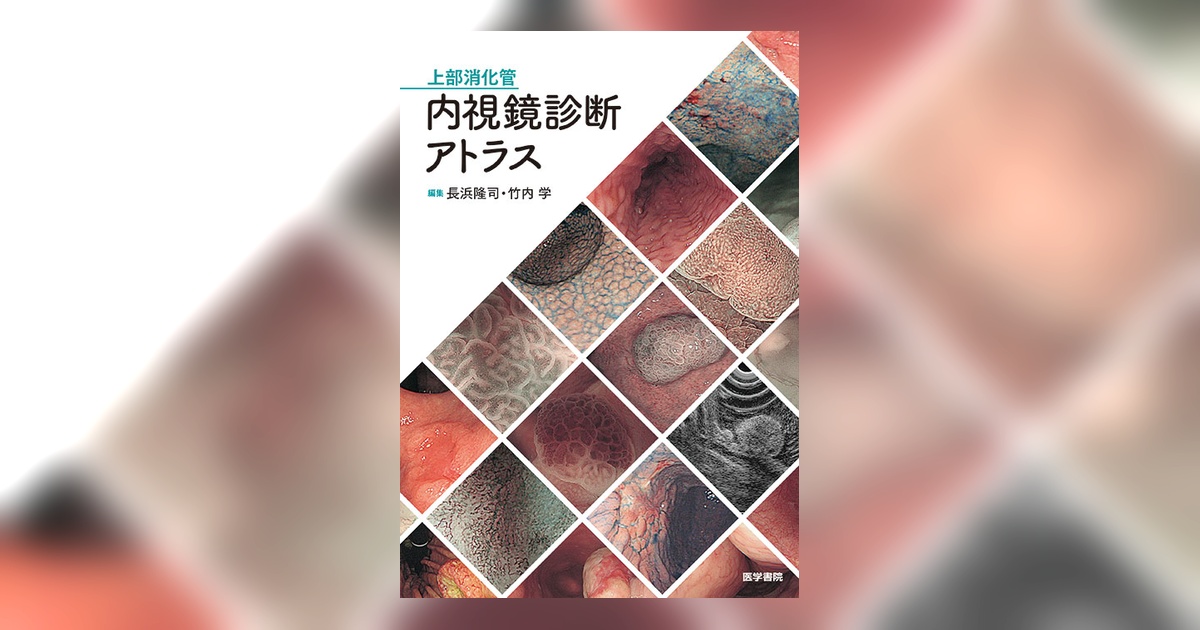 内視鏡診断アトラス 2巻セット 上部消化管内視鏡診断アトラス | 長浜 隆司, 竹内 学 |本 | 通販 | Amazon