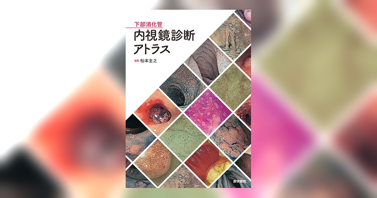 下部消化管内視鏡診断アトラス | 書籍詳細 | 書籍 | 医学書院
