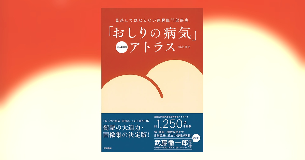 おしりの病気」アトラス [Web動画付] | 書籍詳細 | 書籍 | 医学書院