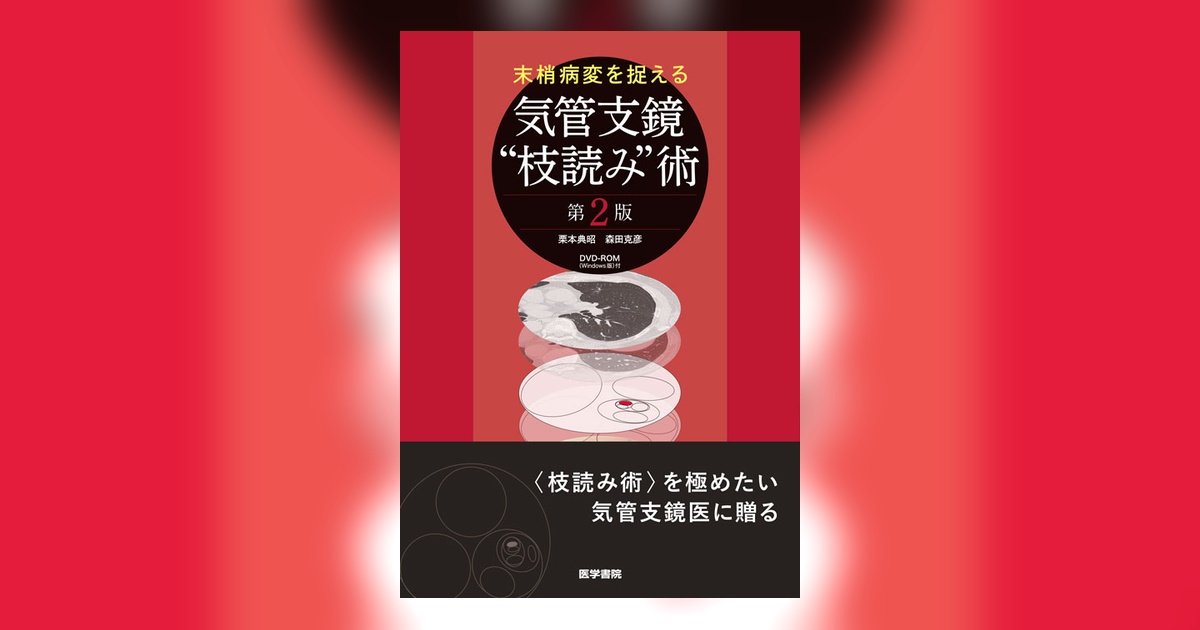 末梢病変を捉える気管支鏡\"枝読み\"術 末梢病変を捉える 気管支鏡“枝読み”術 [DVD-ROM(Windows版)付] 第2版
